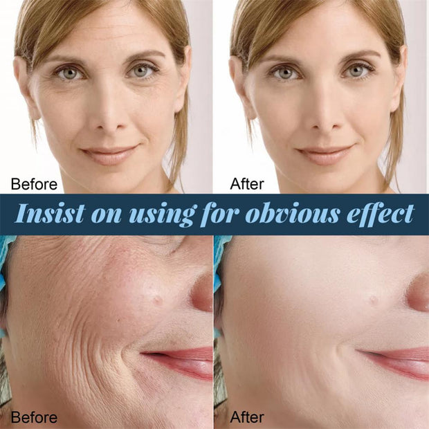 Invisible face lift tape. Perfect for Tight Facial Line Wrinkle Sagging Skin